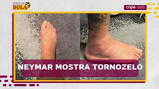 NEYMAR mostra fotos de TORNOZELO INCHADO após LESÃO e ficar de FORA da fase de grupos da COPA