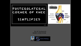 Postero-lateral corner of Knee-  Anatomy simplified