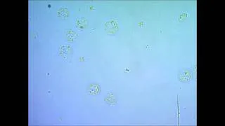 Хлорелла Chlorella vulgaris under microscope