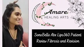 SonoBello Abx Lipo360 Patient Review  Fibrosis and Revision