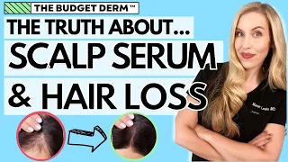 The Truth About Scalp Serums and Hair Loss! | The Budget Derm Explains
