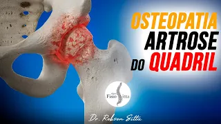 ARTROSE do QUADRIL QUIROPRAXIA MANIPULAÇÃO COXOFEMORAL OSTEOPATIA Clínica Dr. Robson Sitta ®