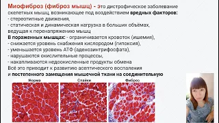 Моя история болезни и лечения. Миофиброз. Миофасциальный синдром (МФС). Фиброз мышц живота