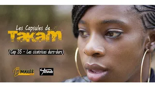 Les Capsules de Takam, Cap 35   Les cicatrices durs durs Feat Larissa Manfo