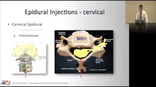 23. Procedures for spinal and radicular pain