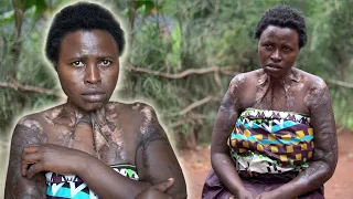 My Husband Burnt Me Alive Because He Was Jealous : EXTRAORDINARY STORY