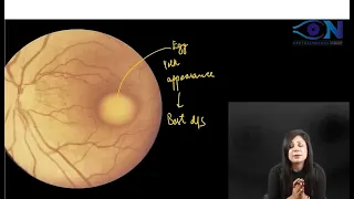 Ophthalmology Rapid Revision_Image Based Question_21 || Dr. Niha Aggarwal