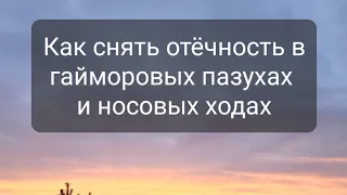 Как снять отёчность в гайморовых пазухах и носовые ходах