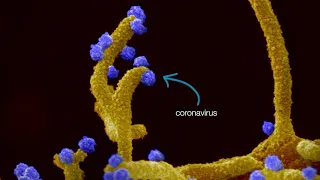 Coronavirus forces cells to produce tentacle-like structures that infect neighboring cells