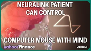 Elon Musk's  Neuralink: First human patient can control a computer mouse with mind