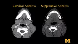 Suresh Mukherji, MD FACR,  "Emergency Head and Neck Radiology"