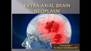 12-Extra-axial brain neoplasm