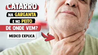 De onde vem o CATARRO que desce na GARGANTA e o do PEITO? │ Médico Explica