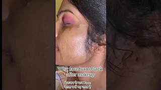 मेकअप करने के बाद फेस काला क्यों पढ़ जाता है|Why does the face turn black after apply makeup?#viral