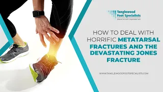 How to Deal with Horrific Metatarsal Fractures and the Devastating Jones Fracture