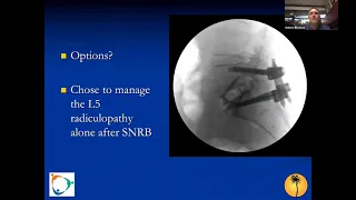 Degenerative Reconstruction: Why Alignment Matters