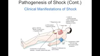 Chapter 20 Shock BIOL300