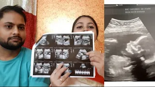 report se Jane baby boy h Ya girl//level 2 ultrasound//ANAMALY SCAN AT 19TH WEEKS