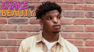 Teen With Facial Difference Becomes A Model | SHAKE MY BEAUTY