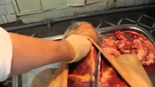 Вскрытие человека (морг) / Human autopsy