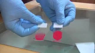 Aspirated Material Slide Techniques