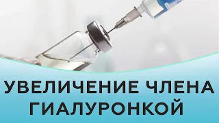 Увеличение члена гиалуроновой кислотой