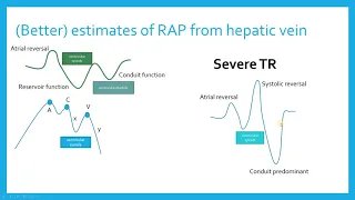 Critical Care Echo of the RV (Part 4) - Hepatic venous flow tracings