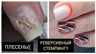 ПЛЕСЕНЬ  как быть?