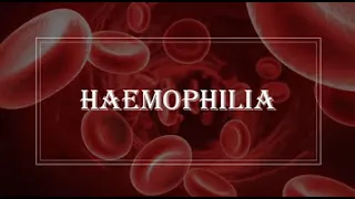 [Pediatrics] Haemophilia