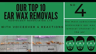 TOP 10 EAR WAX REMOVAL VIDEOS - NUMBER 4