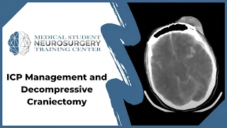 ICP Management and Decompressive Craniectomy