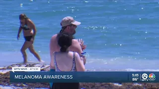 Melanoma Awareness Month: How to prevent melanoma