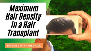 What is the Maximum Hair Density in a Hair Transplant | Bitesize with Bisanga Ep. 13 (BHR Clinic)