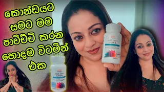 කොන්ඩයට සමට මම පාවිච්චි කරන හොදම විටමින් එක​