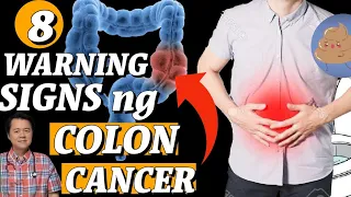 8 Warning Signs ng Colon Cancer - Tips by Doc Willie Ong #1081b