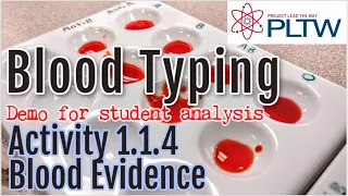 PBS 1.1.4 ABO Blood Typing | Demo for Student Analysis