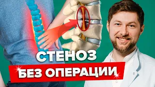 КАК ЛЕЧИТЬ СТЕНОЗ БЕЗ ОПЕРАЦИИ! Причины появления стеноза позвоночного канала