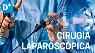 Ventajas de la cirugía laparoscópica