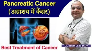 Pancreatic Cancer Treatment | अग्नाशय में कैंसर का इलाज | Homeopathic Treatment of Cancer