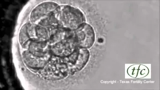 Human Embryo Growing from Fertilization to Day 6 Blastocyst