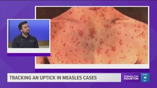 Tracking an uptick in measles cases