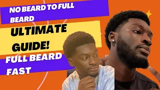 Full Beard in 6 Months with Minoxidil & Derma Roller! Complete Growth Guide