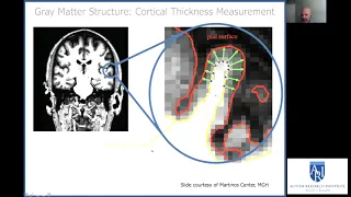 Middle and Older Adulthood in Autism: Brain and Behavioral Outcomes