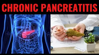 CHRONIC PANCREATITIS:  Signs, Symptoms, Causes