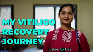 Vitiligo success stories|Dr Nitika Kohli|vitiligo leucoderma