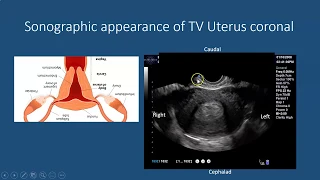 Point of Care OB Ultrasound