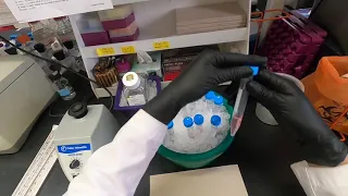 Cell Cycle Analysis by Flow Cytometry