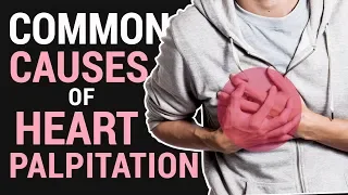 Common Causes of Heart Palpitation - by Dr Willie Ong #53b