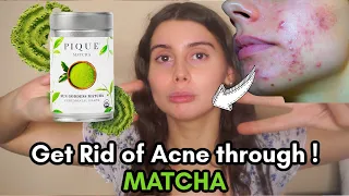 How I Clear My Skin With Matcha :) All of  the benefits to get rid of acne