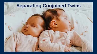 Separating Conjoined Twins at UC Davis Children's Hospital